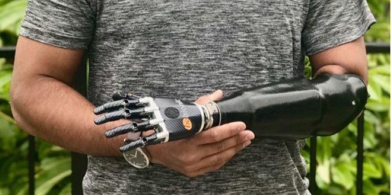 Dr. Pandit posing with his prosthesis 