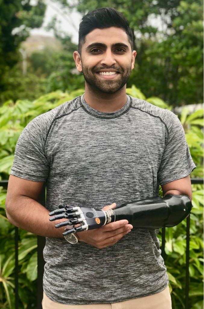 Dr. Pandit full body shot with his prosthesis
